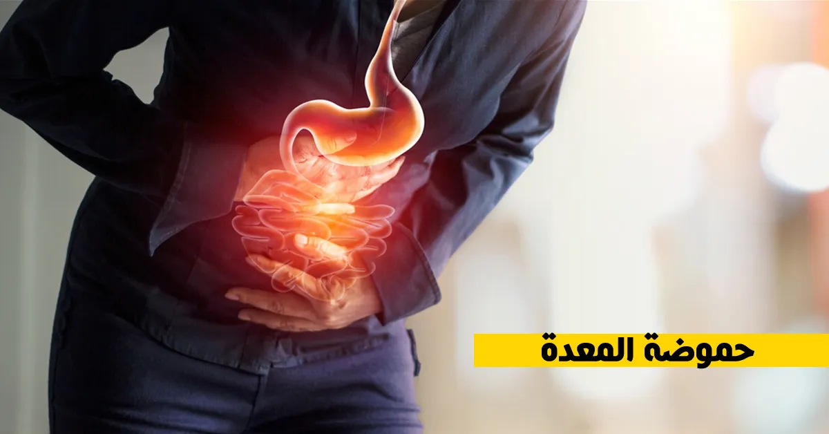 حموضة المعدة